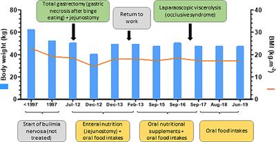 Gastric Necrosis After Binge Eating in Bulimia: Recovery From Eating Disorder After Total Gastrectomy